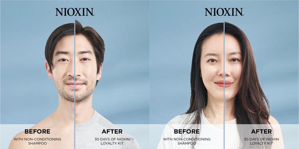, Get fuller hair and control hair fall with Nioxin’s 6 Systems